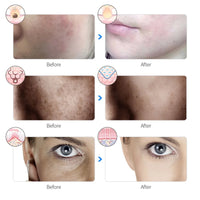 Masque LED maDomotech - vue arriere
